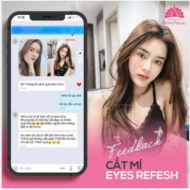 NÓI KHÔNG VỚI TRỢN MÍ - SỞ HỮU MẮT 2 ĐẸP TỪNG CENTIMET VỚI CẮT MÍ EYES REFESH