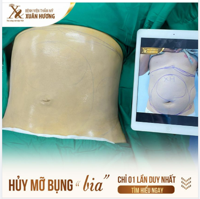 NỮ CÓ EO THON - NAM CŨNG CẦN BỤNG GỌN!