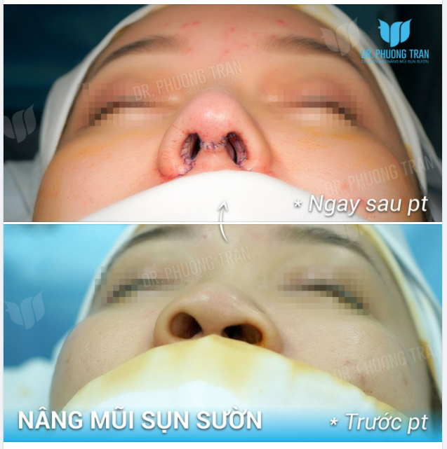 ODY SHAMING - NỖI ĐAU KÍ ỨC