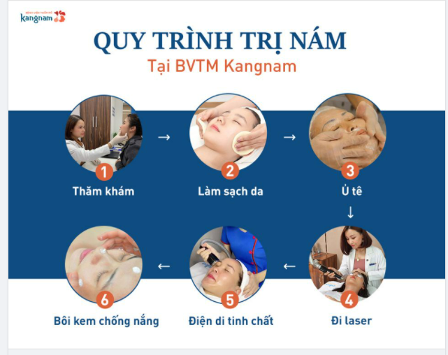 Quy trình trị NÁM tại BVTM Kangnam