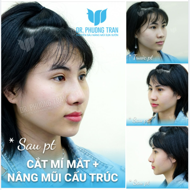 RỐT CUỘC, CỐ GẮNG NHIỀU NHƯ VẬY, LÀ VÌ ĐIỀU GÌ?