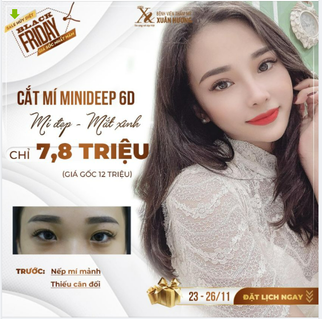 SALE HỦY DIỆT - SĂN ƯU ĐÃI CẮT MÍ LIỀN TAY: CHỈ 7,8 TRIỆU (giá gốc 12 triệu)