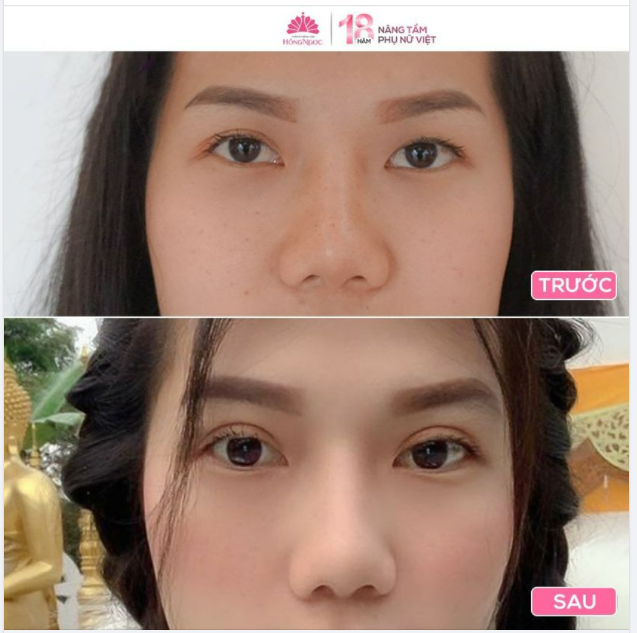 SAO PHẢI DÀNH CẢ THANH XUÂN ĐỂ KÍCH MÍ?