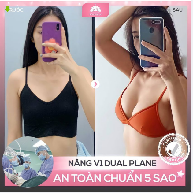 SAY BYE "LÉP XẸP" - VÒNG 1 ĐẸP SEXY CHỈ TỪ 48TR