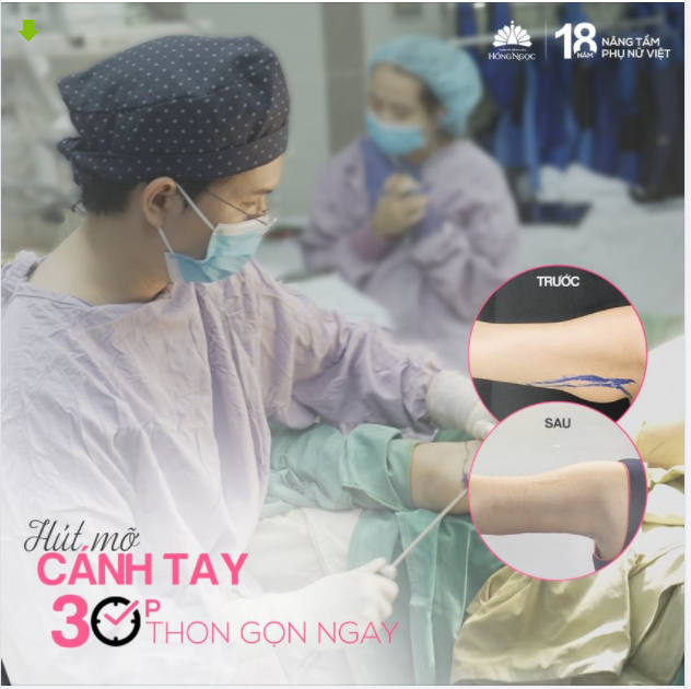 ''SAY BYE'' MỠ THỪA CÁNH TAY CHỈ TRONG 30P