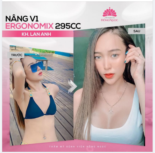 SIÊU PHẨM V1 EGRO SIZE 295CC SAU 30 NGÀY CỦA CÔ NÀNG LAN ANH ĐẸP NGẤT NGÂY CẢ NHÀ Ạ