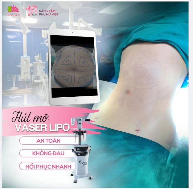 TẠM BIỆT "BODY SHAMING", CHỊ KHÁCH LỘT XÁC NGỠ NGÀNG SAU 90P