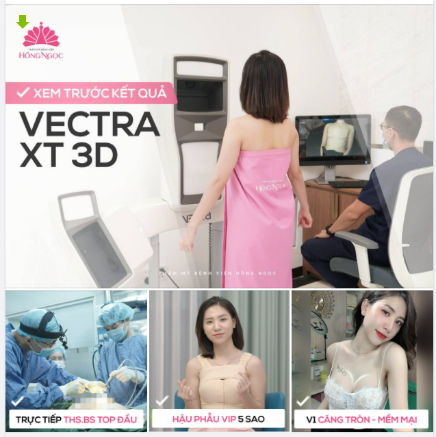 TĂNG SIZE VÒNG 1 AN TOÀN - XEM TRƯỚC KẾT QUẢ CHÍNH XÁC 98% VỚI VECTRA 3D