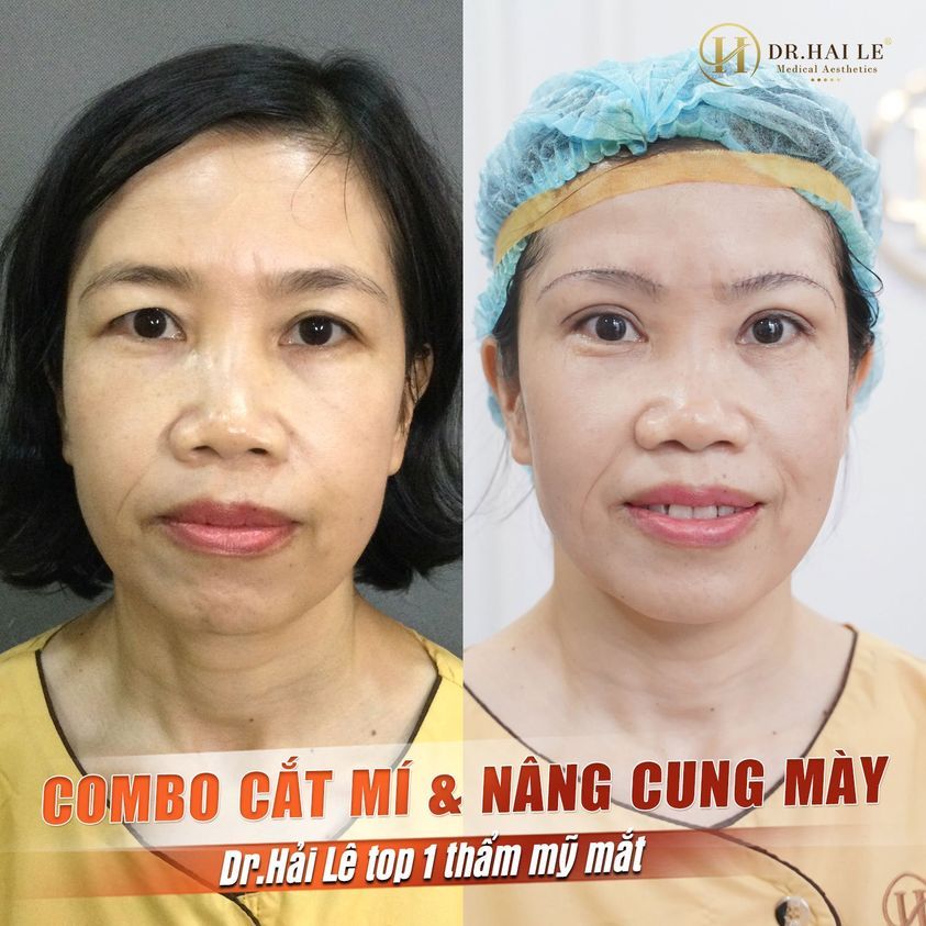 THAY ĐỔI HOÀN HẢO VỚI COMBO CẮT MÍ NÂNG CUNG MÀY