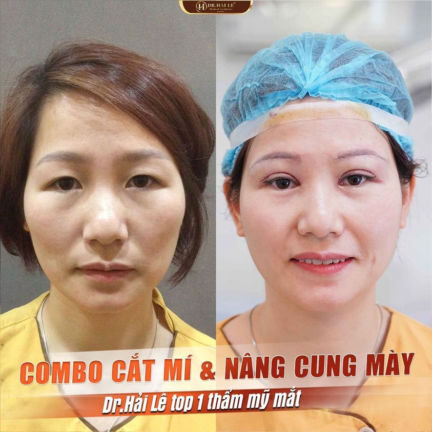 THAY ĐỔI HOÀN HẢO VỚI COMBO CẮT MÍ NÂNG CUNG MÀY