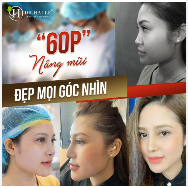 THAY MŨI PHONG THỦY - ĐÓN TÀI LỘC PHÚ QUÝ. BẠN NGHĨ SAO