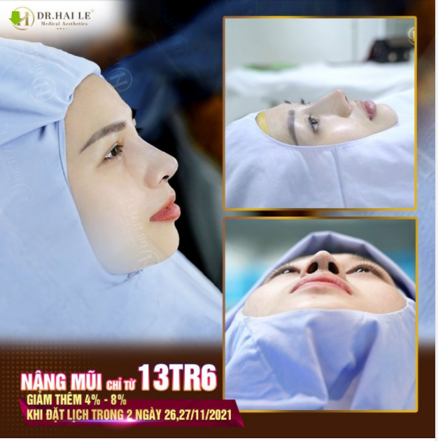 THẾ HỆ TRẺ CHỌN NÂNG MŨI ĐỂ TỰ TIN HƠN!