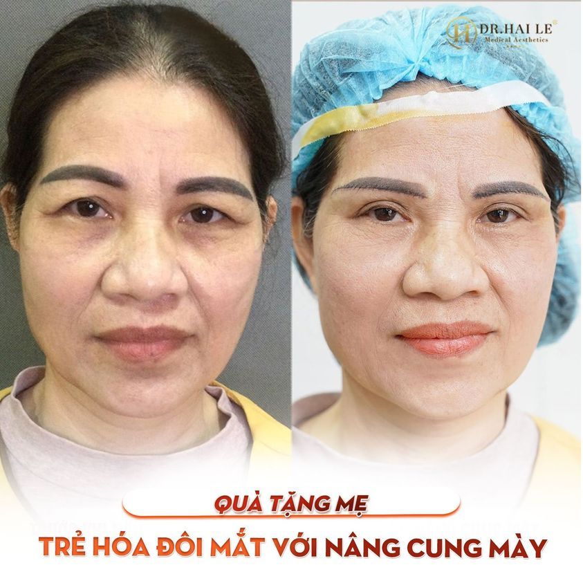 Thời gian lấy đi tuổi xuân của mẹ Có bao giờ bạn từng nghĩ chúng ta, vì quá bận bịu, mải mê với cuộc sống mà chợt quên đi điều gì đó…