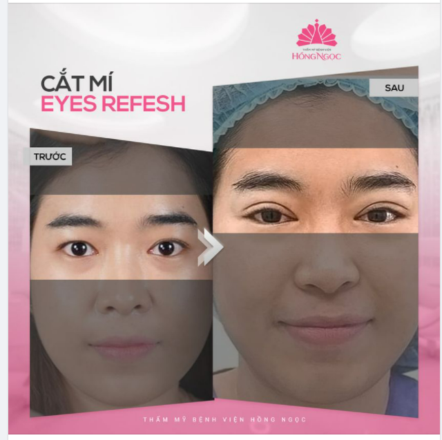 TIÊU CHÍ CHỌN ĐỊA CHỈ CẮT MÍ CỦA CÁC BẠN LÀ GÌ