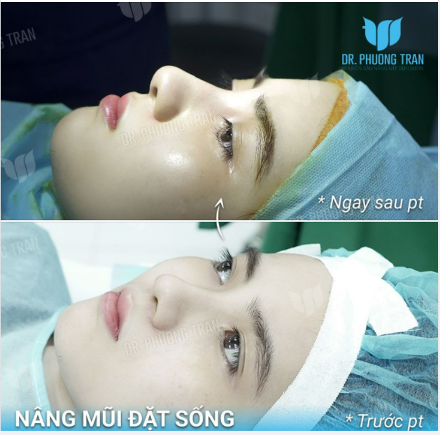 Tôi có một sự rung cảm đặc biệt với cái đẹp