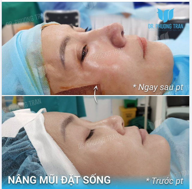 TRỄ CÒN HƠN KHÔNG BAO GIỜ
