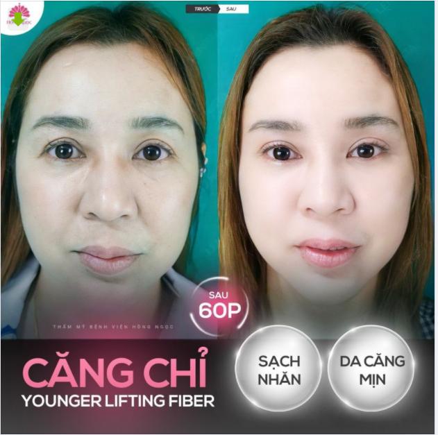 TRẺ HÓA NGOẠN MỤC CHỈ TRONG 60P - BẠN CÓ TIN?