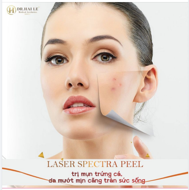 TRỊ MỤN TRỨNG CÁ, DA MƯỚT MỊN, CĂNG TRÀN SỨC SỐNG.!
