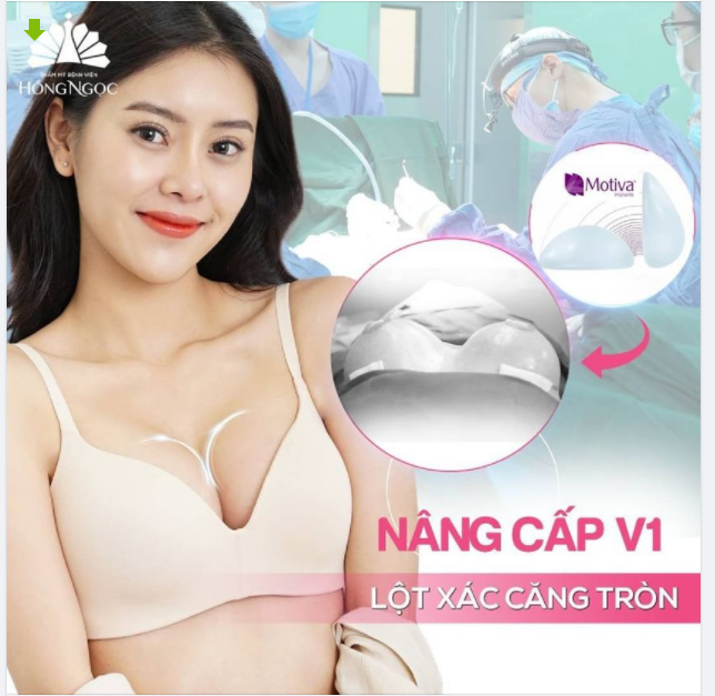 TRIỆU HỒI TEAM LÉP - TEAM SÂN BAY VỀ NGAY TEAM HỒNG NGỌC