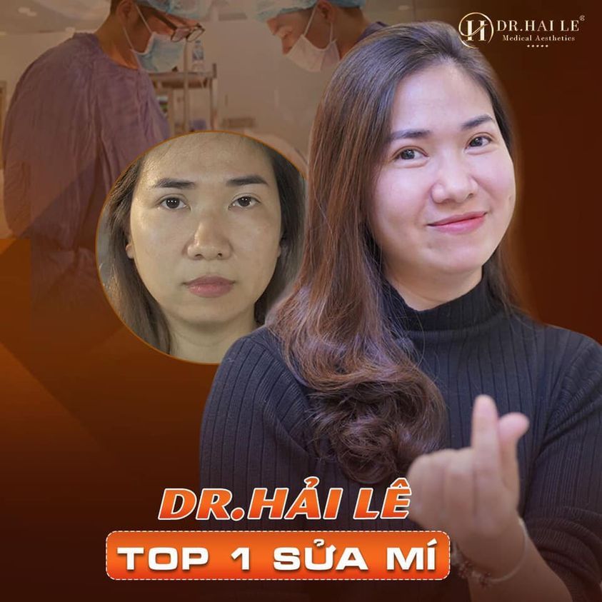Trót cắt mí lỗi, hỏng tại cơ sở thiếu uy tín. PHẢI LÀM SAO?