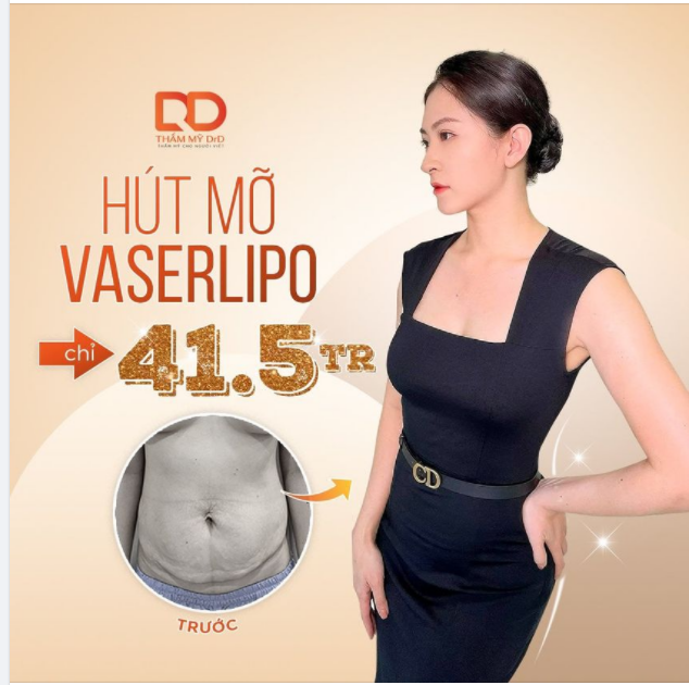 Tự tin mặc váy body nhờ Công nghệ hút mỡ Vaserlipo
