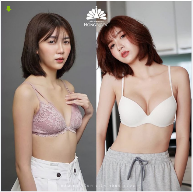 TUẦN VÀNG NÂNG NGUC - GIÁ SỐC CHỈ 48TR