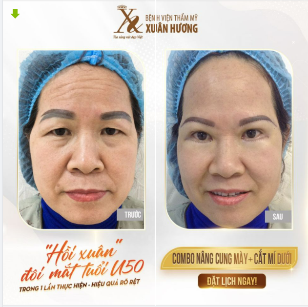 U50+ VẪN CÒN "XUÂN" NẾU BIẾT SỬ DỤNG "TUYỆT KĨ " ĐƠN GIẢN NÀY!