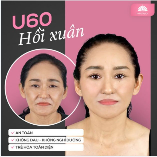 U60 HỒI XUÂN - HACK TUỔI SAU CĂNG CHỈ YLF