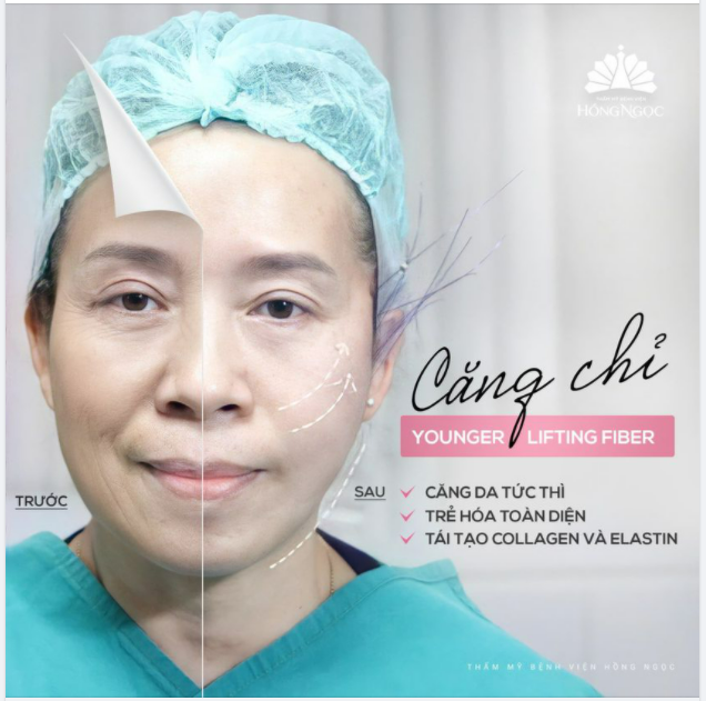 U70 SỞ HỮU HAI NỬA GƯƠNG MẶT LỆCH NHAU GẦN CHỤC TUỔI NHỜ CÔNG NGHỆ CĂNG CHỈ YLF TẠI HỒNG NGỌC.