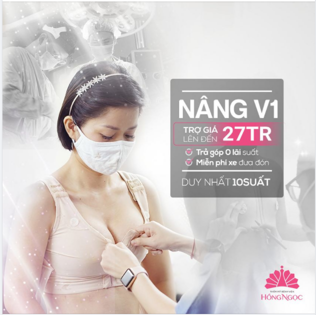 V1 VỪA TAY - ĐỘ NGAY KẺO LỠ