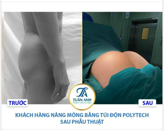 Vòng 3 căng tròn, mặc gì cũng đẹp