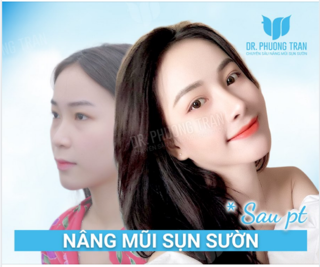 XINH ĐẸP CHÍNH LÀ MỘT CÁCH HẠNH PHÚC