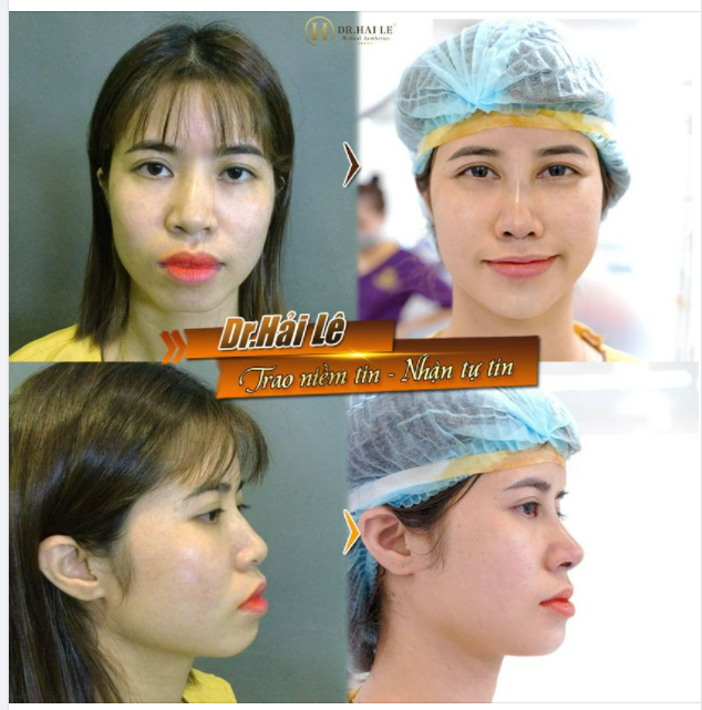XINH ĐẸP LÀ ĐẶC QUYỀN CỦA PHỤ NỮ