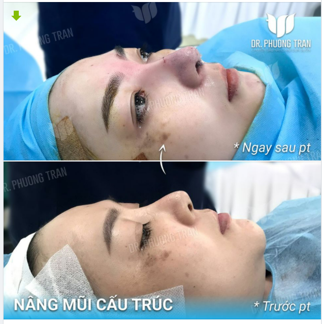 XINH ĐẸP TRƯỚC TIÊN LÀ VÌ MÌNH, SAU MỚI VÌ NGƯỜI KHÁC