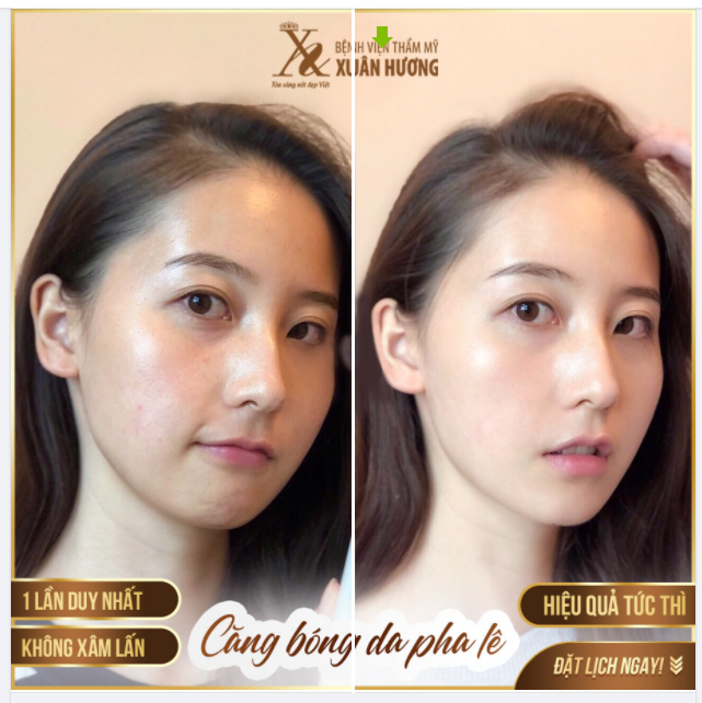YÊU DA BÓNG KHỎE - TƯƠI TRẺ SỨC SỐNG