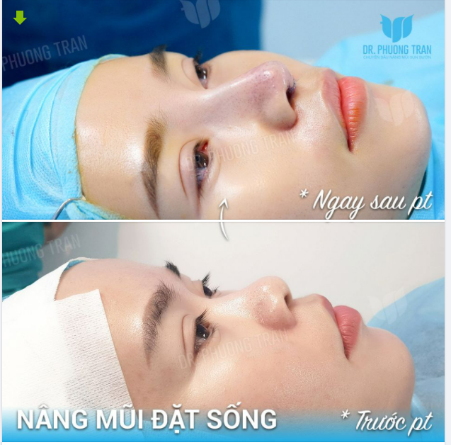 20 PHÚT CHO 1 SỰ THAY ĐỔI NGOẠN MỤC, XỨNG ĐÁNG KHÔNG?