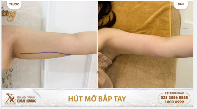BÀI VIẾT NÀY DÀNH CHO TEAM: "NHỮNG CÁNH TAY LỰC ĐIỀN"