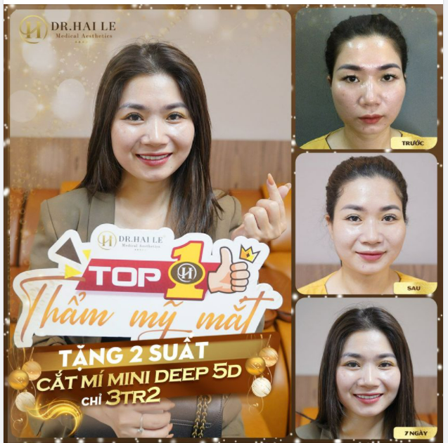 BẠN CÓ HẸN VỚI DR.HẢI LÊ CẮT MÍ - THAY ĐỔI VẺ ĐẸP "CỬA SỔ TÂM HỒN" VỚI SIÊU ƯU ĐÃI CUỐI NĂM.!!!