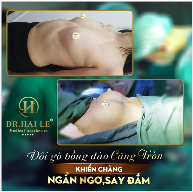 BẬT MÍ BÍ KÍP SỞ HỮU VÒNG 1 CĂNG TRÀN