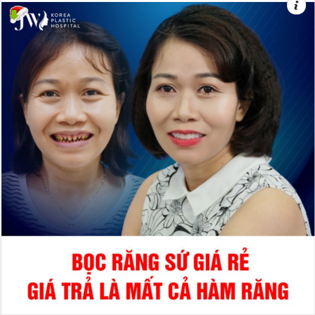 BỌC RĂNG SỨ GIÁ RẺ, GIÁ TRẢ LÀ MẤT CẢ HÀM RĂNG