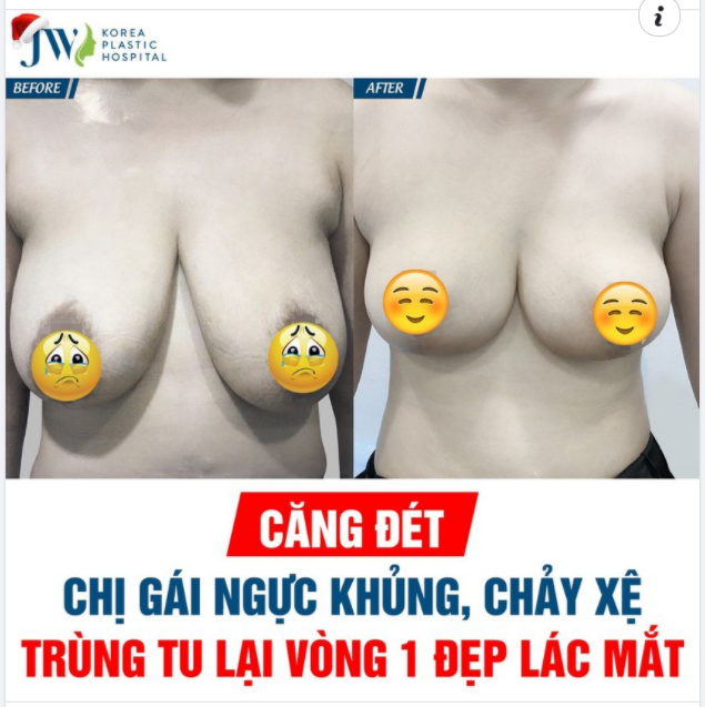 CĂNG ĐÉT: CHỊ GÁI NGỰC KHỦNG, CHẢY XỆ TRÙNG TU LẠI VÒNG 1 ĐẸP LÁC MẮT