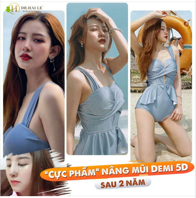 CÂU CHUYỆN NÂNG MŨI ĐỔI MỆNH: "Đẹp tự nhiên" có phải là một trở ngại
