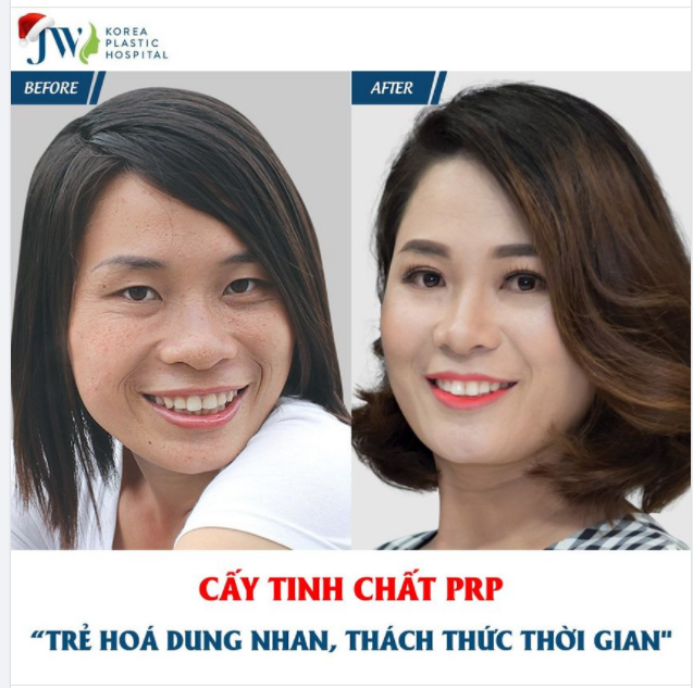 CẤY TINH CHẤT PRP - TRẺ HOÁ DUNG NHAN, THÁCH THỨC THỜI GIAN.
