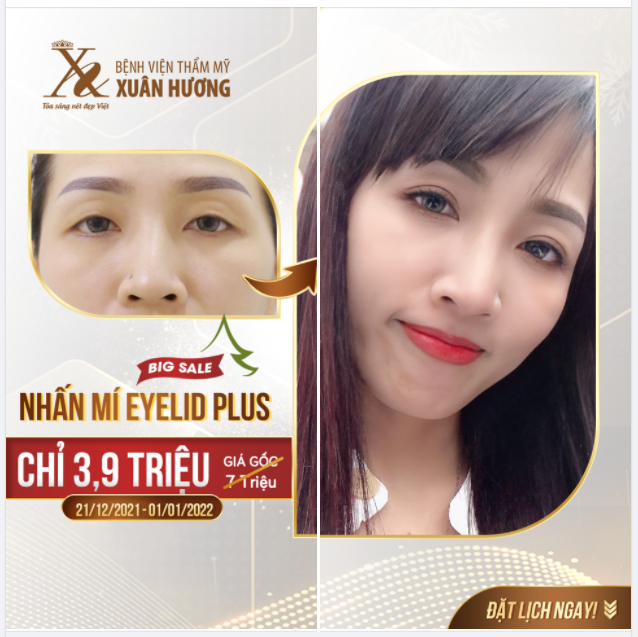 CHỈ 3,9 TRIỆU - NHẤN MÍ SIÊU XINH - "ĐỐN TIM" KHÁCH HÀNG MỌI LỨA TUỔI