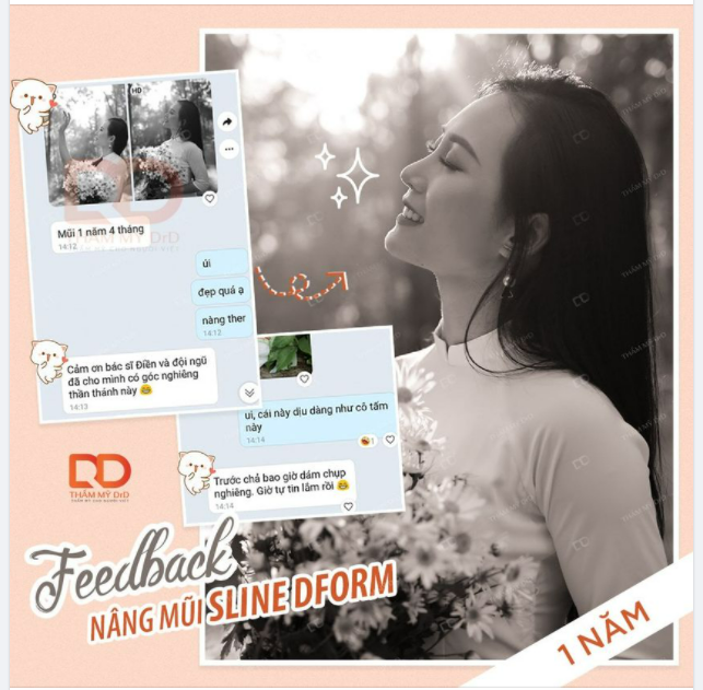 Chỉ cần Nâng mũi Sline Dform, có ngay góc nghiêng thần thánh.