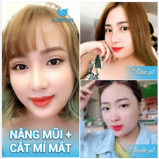 Chiều nay có trận mưa rào Tiện cho anh hỏi lối vào team em