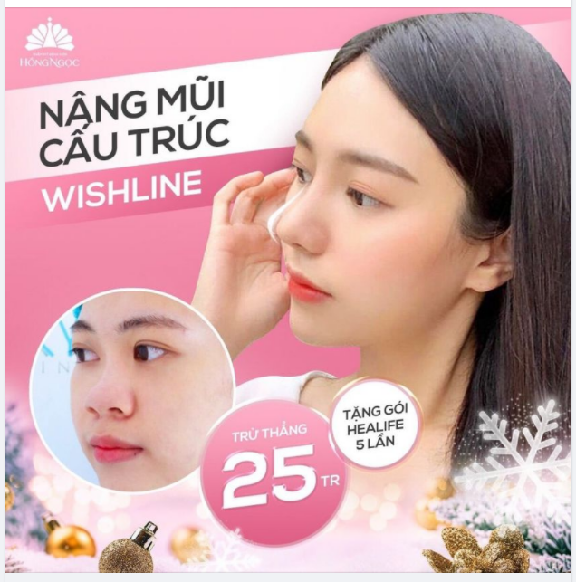 CỰC PHẨM GÓC NGHIÊNG ĐƯỢC TÁI SINH TỪ CHIẾC MŨI NHIỀU KHUYẾT ĐIỂM