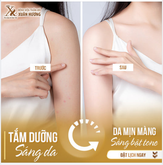 DA SÁNG MỊN - TỰ TIN ĐÓN MÙA LỄ HỘI, DIỆN MỌI TRANG PHỤC BẠN MUỐN.