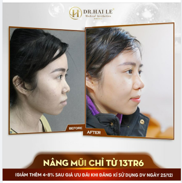 DR.HẢI LÊ TRI ÂN CUỐI NĂM - BÙNG NỔ SIÊU ƯU ĐÃI.!!!