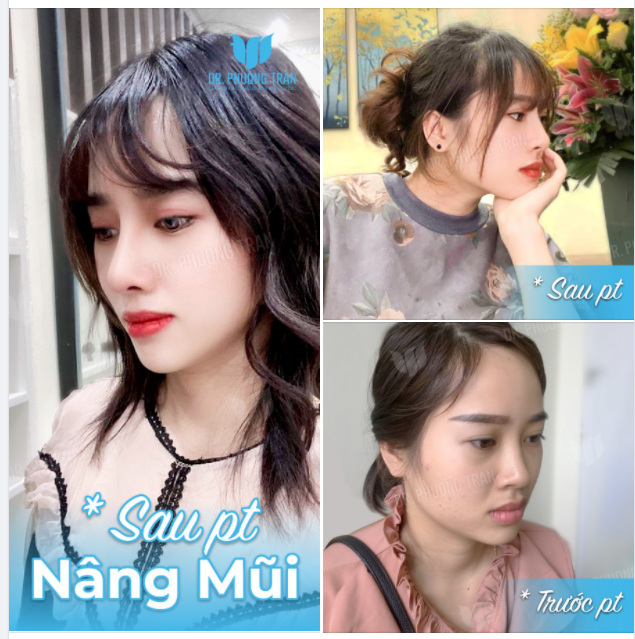 Đủ nắng hoa sẽ nở Đủ mạnh mẽ mũi xinh sẽ thuộc về mình!